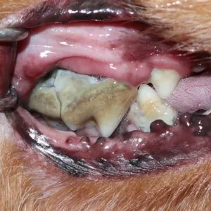 歯ぐきが下がり歯の根元が見えてくる