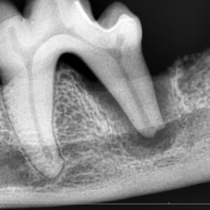 （犬）重度の歯周病